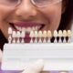 8 Benefits of Dental Veneers