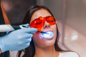 9 Benefits of Laser Dentistry