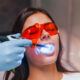 9 Benefits of Laser Dentistry