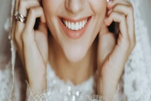 Affordable Cosmetic Dentistry for Weddings in Kirkland