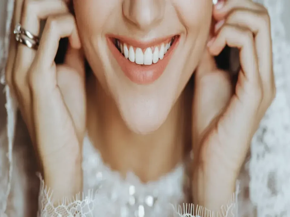 Affordable Cosmetic Dentistry for Weddings in Kirkland