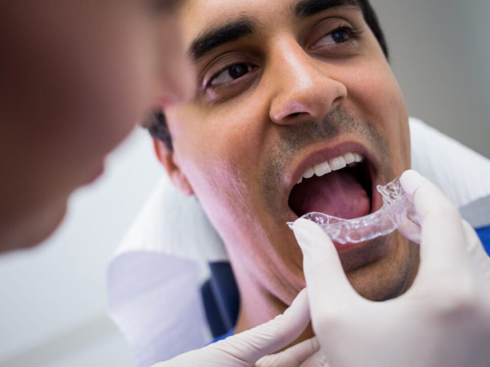 What Happens after Invisalign?
