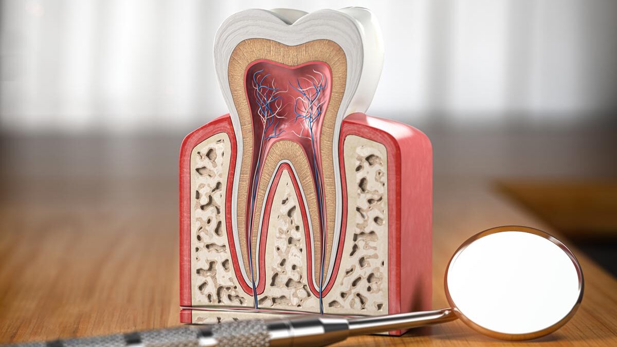 Apicoectomy vs Root Canal