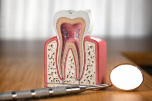 Apicoectomy vs Root Canal