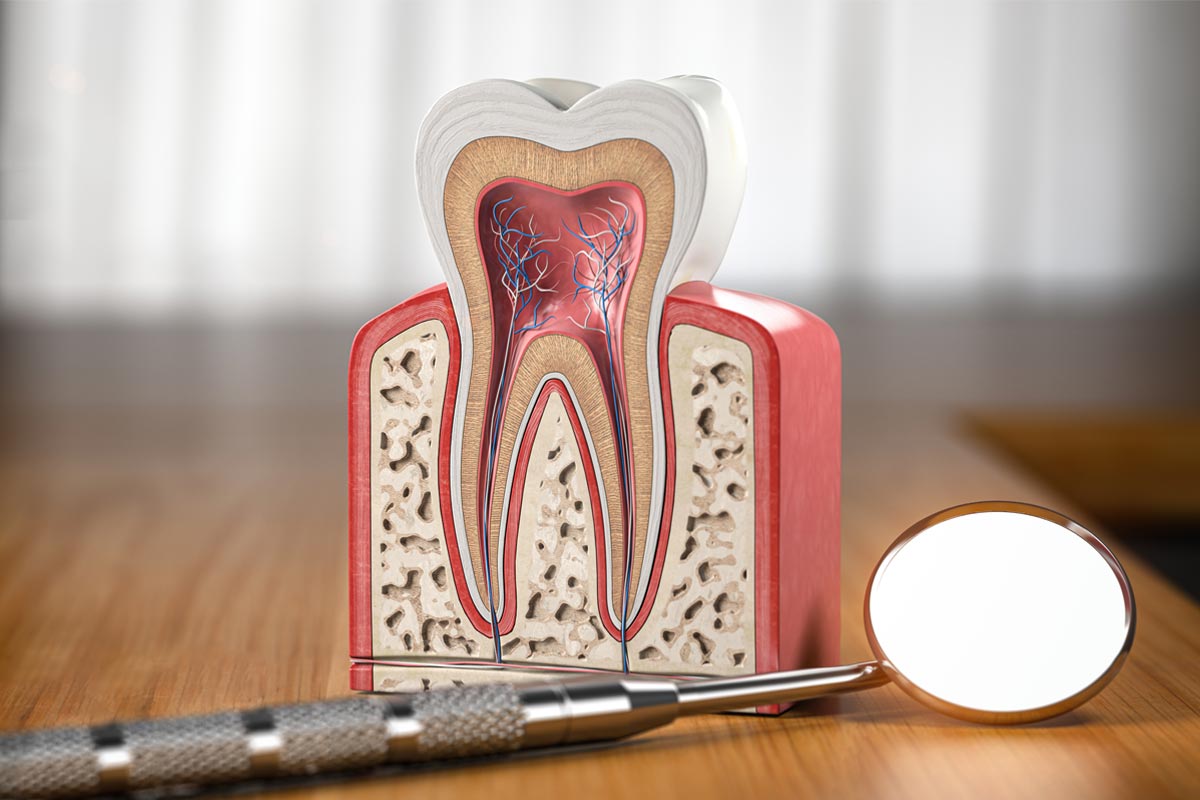 Apicoectomy vs Root Canal