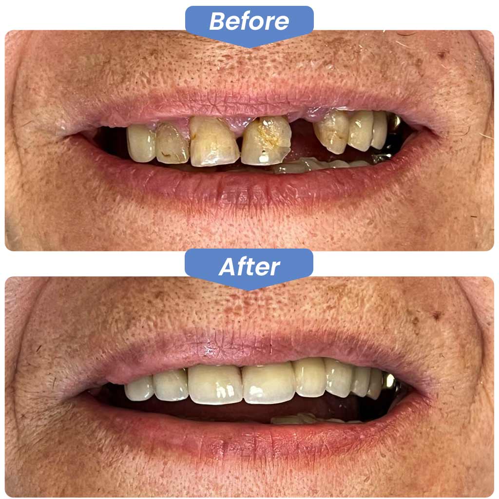 Before After Dental