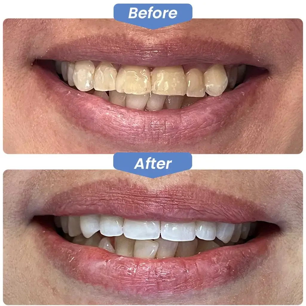 Before After Dentistry, Dentist, Dental, Kirkland Dental Excellence