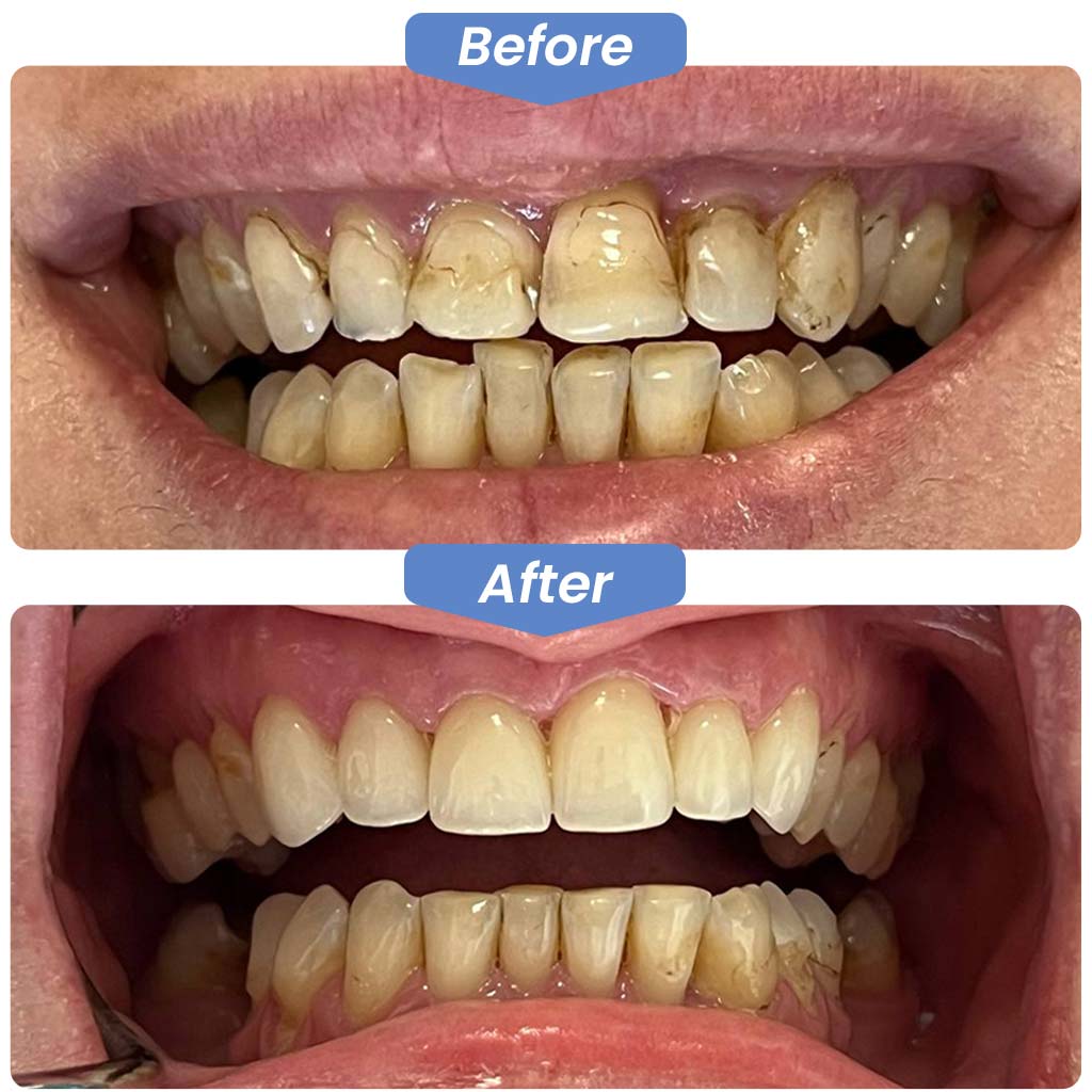 Before After Dentistry