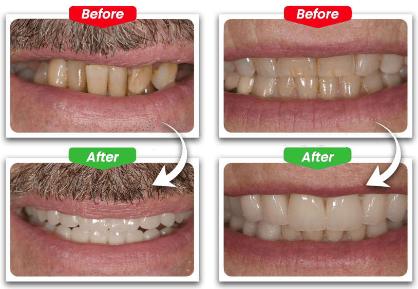 Before and after kirkland dental NEW