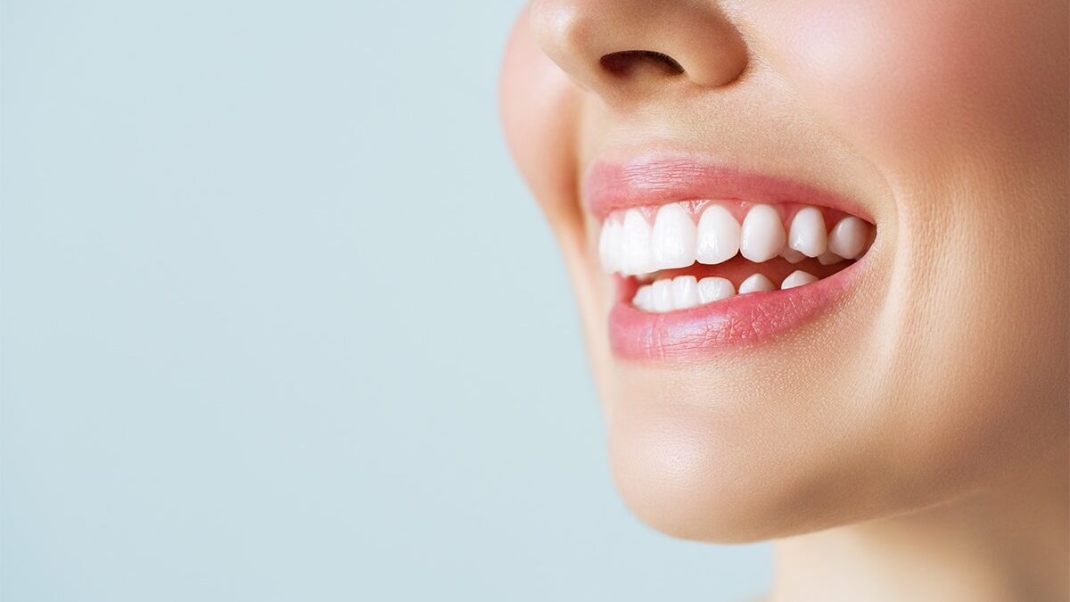 Best Teeth Whitening Method, In Office & At Home