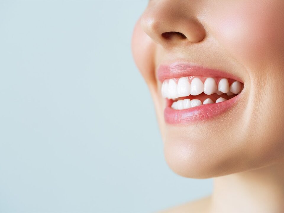 Best Teeth Whitening Method, In Office & At Home