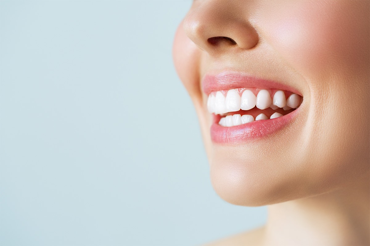 Best Teeth Whitening Method, In Office & At Home