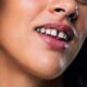 Can Teeth Gaps Be Closed With a Composite Filling?