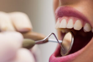 Can You Get Lumineers With Missing Teeth