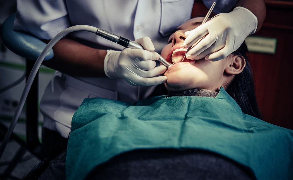 Composite Filling Procedure