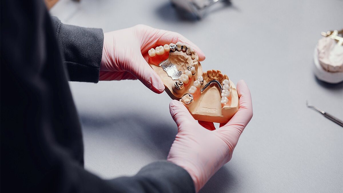 Composite Fillings vs. Metal Fillings: Key Differences Explained