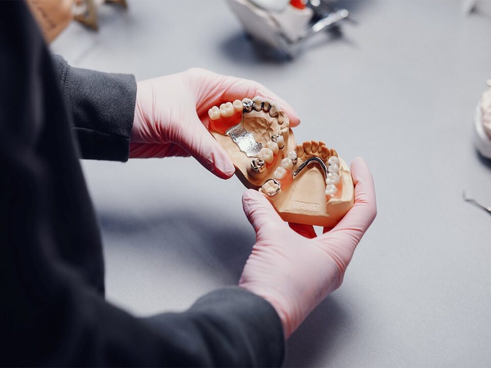 Composite Fillings vs. Metal Fillings: Key Differences Explained