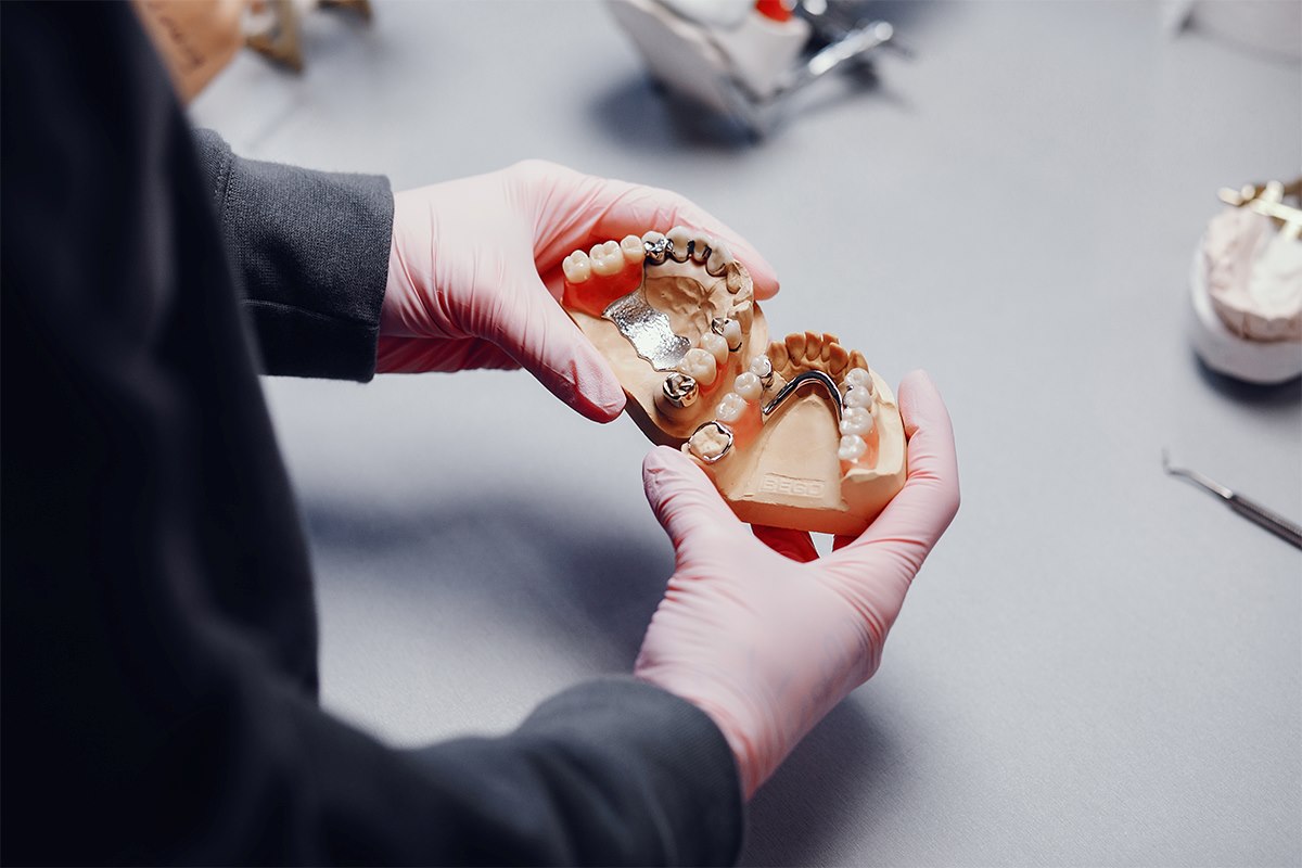 Composite Fillings vs. Metal Fillings: Key Differences Explained