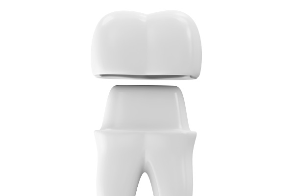Dental Crowns Back