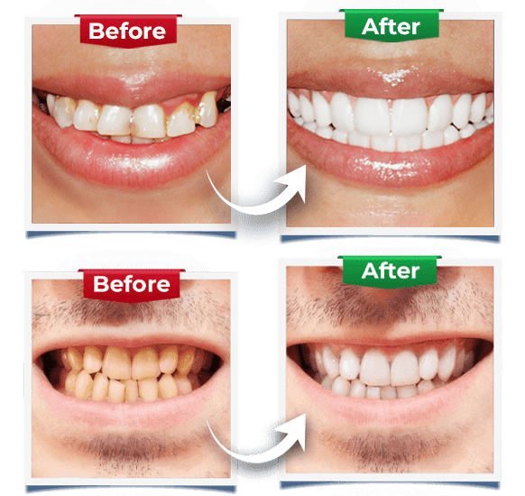 Dental Exam CPC - Before After Kirkland