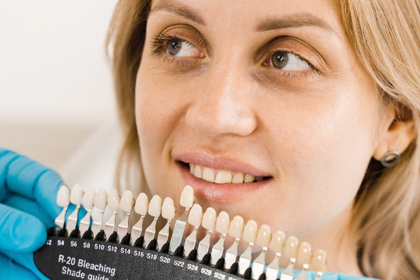 Dental Veneers