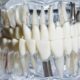 Do Dental Implants Change Your Smile?