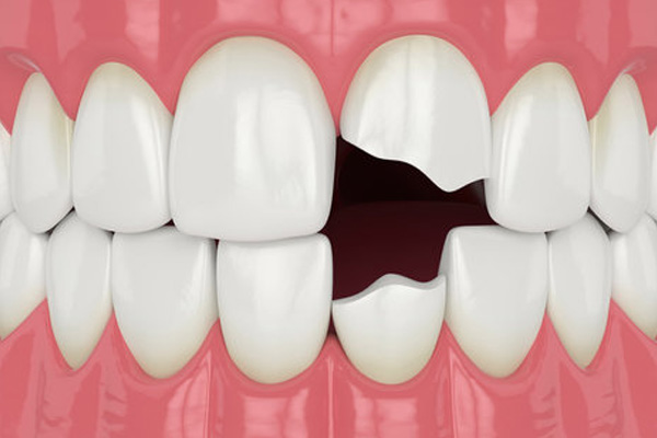 Emergency Dentist Back