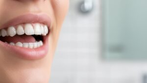 How Much Does Invisalign Cost in Kirkland, Washington?