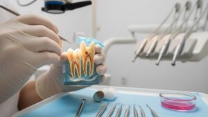 How Much Does a Root Canal Cost in Washington?