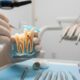 How Much Does a Root Canal Cost in Washington?