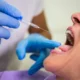 How Much Is Sedation Dentistry in Kirkland