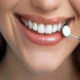 How Much do Same Day Dental Implants Cost in Kirkland, WA