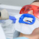 How to Fix Sensitive Teeth After Whitening