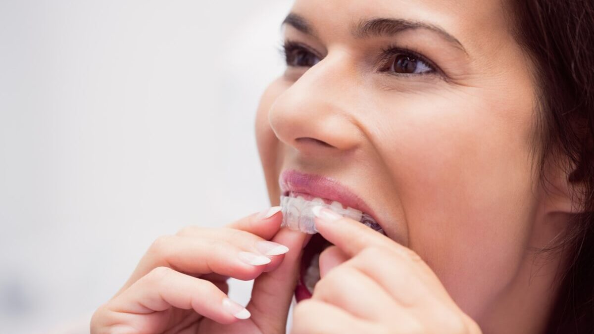 How to Take Care of Invisalign?