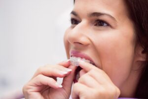 How to Take Care of Invisalign?
