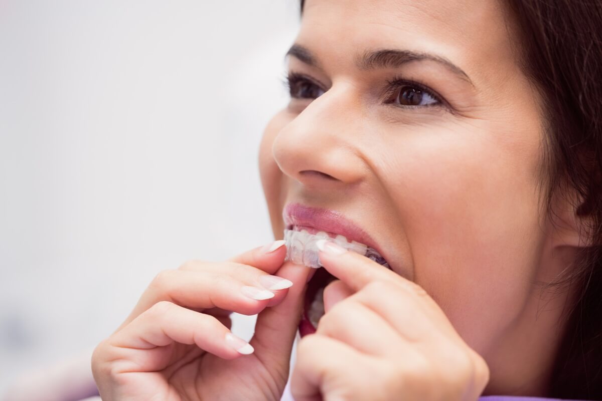 How to Take Care of Invisalign?