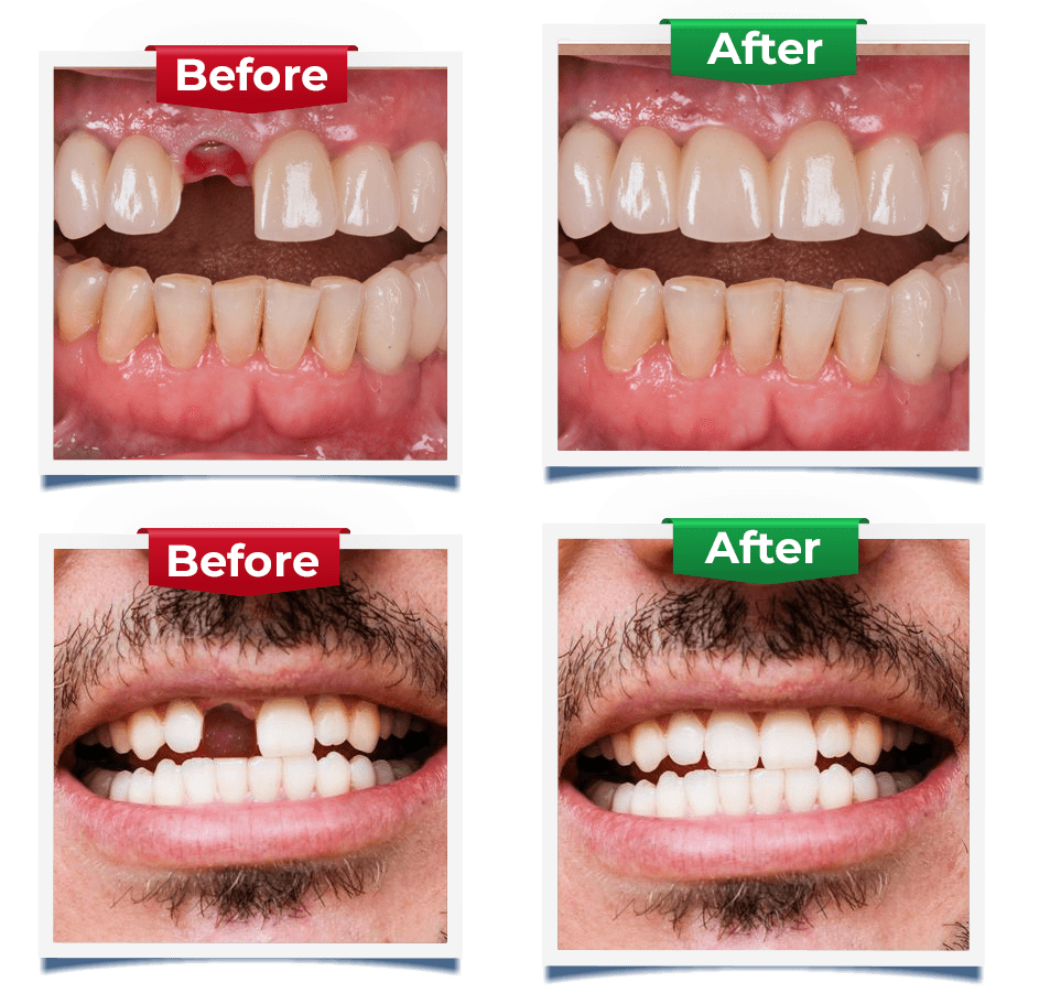 Implant Dentistry Ads Slider