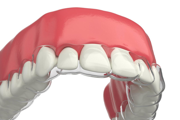 Invisalign Dentist Back