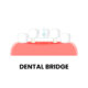 Is There a Dental Bridge for One Tooth?