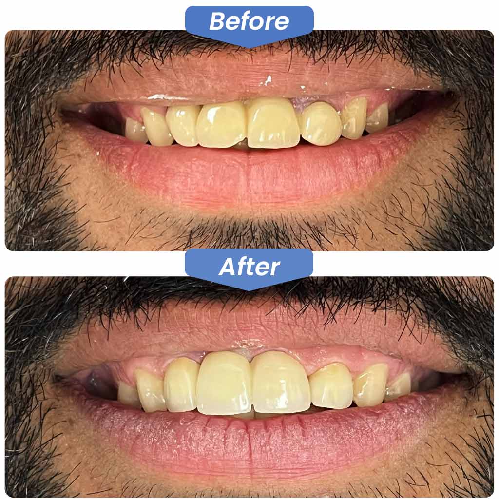 Smile Gallery Kirkland Dental