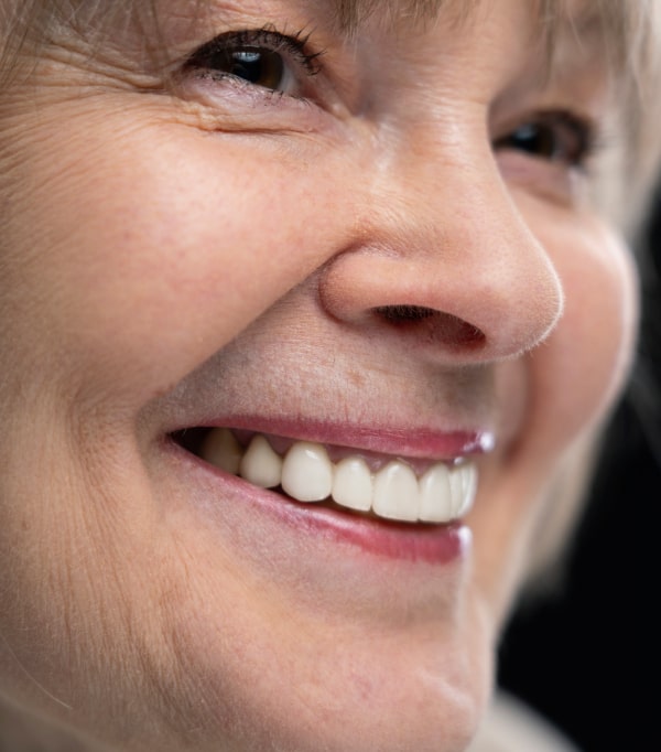 Snap-on Dentures in Kirkland