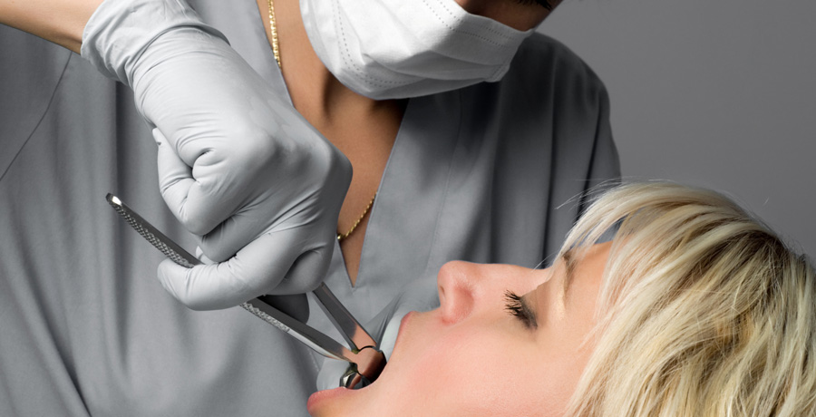 Tooth Extraction