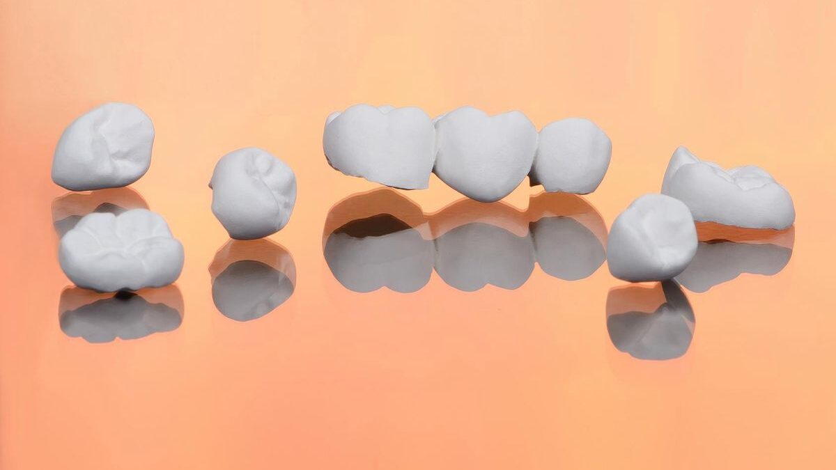 What Are Dental Sealants Made of?