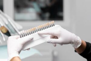 What Are the Differences between Minimal-Prep and No-Prep Veneers?