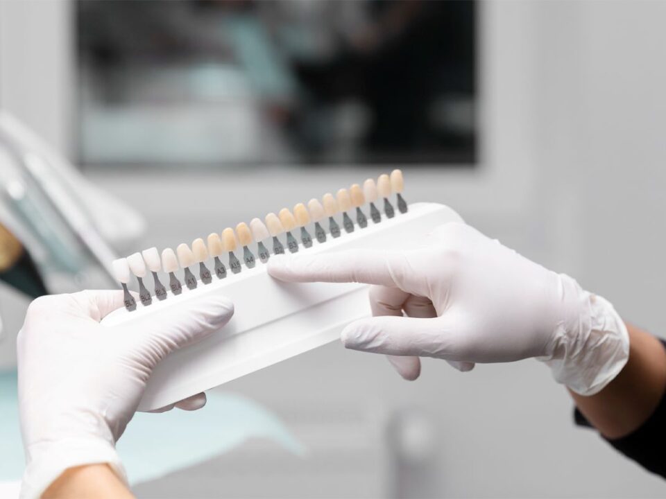 What Are the Differences between Minimal-Prep and No-Prep Veneers?