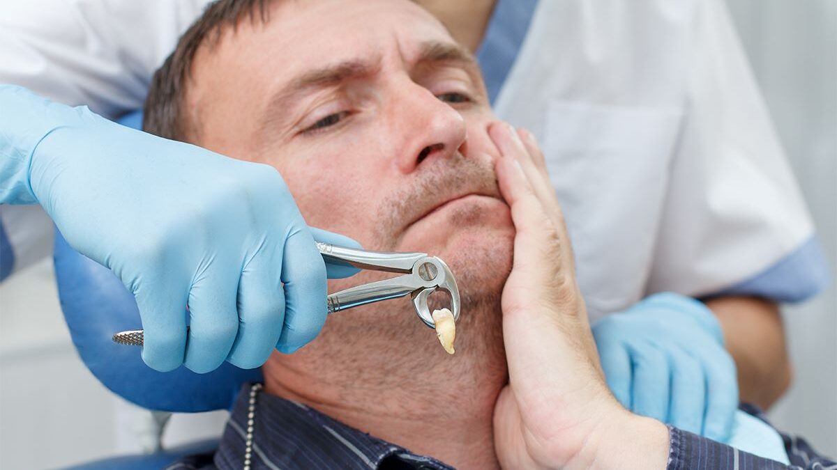 What Is the Worst Day of Pain After Wisdom Tooth Extraction?