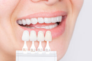 What’s The Difference Between Veneers and Lumineers?