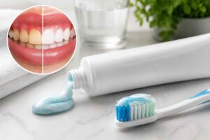 What's the Best Toothpaste for Teeth Whitening