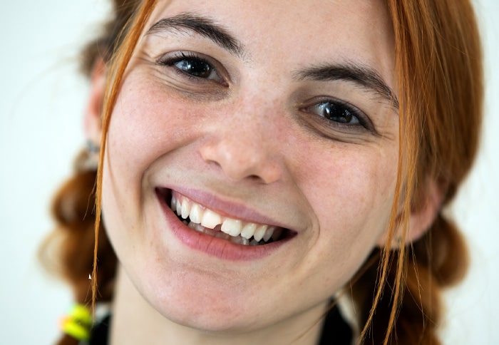 Why Choose Implant Dentistry