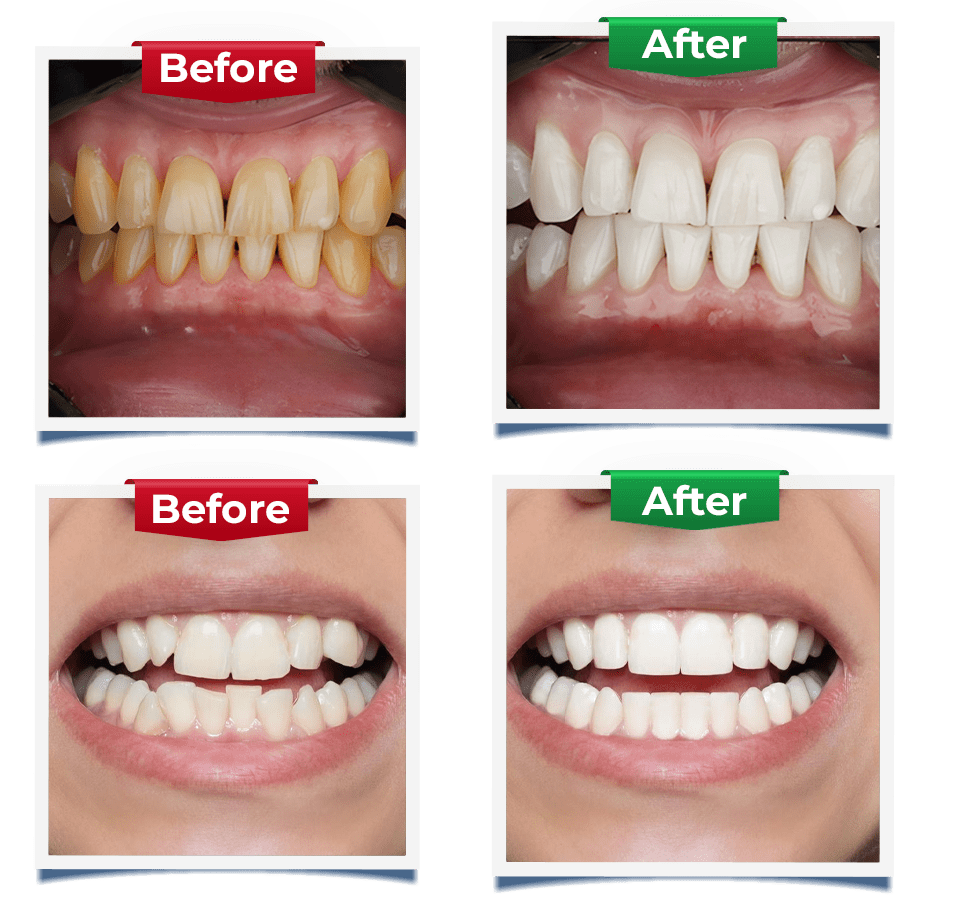 before after kirkland dental special offer